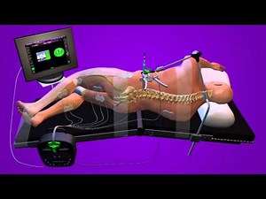 XLIF Animation - Houston Spine Center