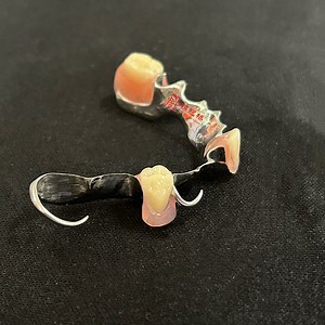 [Hot Item] FDA Certificated 3D Printing Casting Milling Metal Partial Framework Removable Dentures Fast Delivery