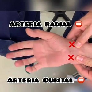 1K views · 34 reactions | Test de Allen. Nunca mejor explicado! | Dr.FJ - Medicina | Facebook