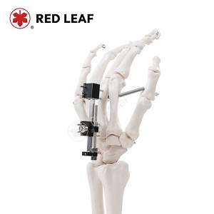 [Hot Item] Universal Compression Extension External Fixator Mini Finger Fracture Orthopedic Fixation