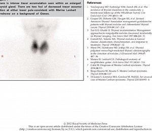 Enfermedad De Graves Basedow Pdf 2013