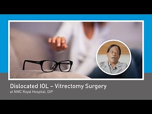 Management Of Dislocated IOL- Glue Fixation at NMC Royal Hospital, DIP