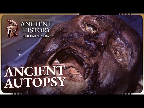 History's Forgotten Diseases | Medieval Dead