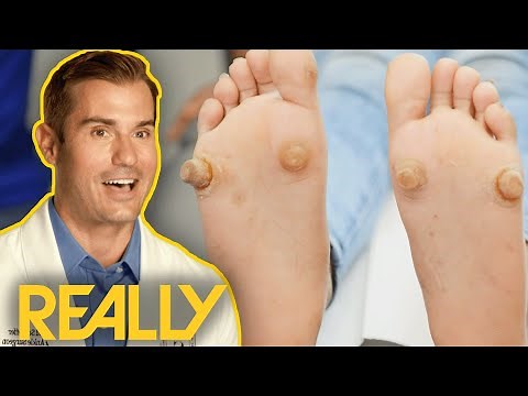 Dr Brad Blown Away By Severe Foot Growths | My Feet Are Killing Me