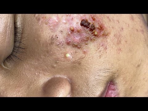 𝐂𝐡𝐢𝐥𝐥 𝐘𝐨𝐮𝐫 𝐋𝐢𝐟𝐞 𝐖𝐢𝐭𝐡 𝐋𝐍𝐆 𝐒𝐤𝐢𝐧 𝐂𝐚𝐫𝐞 # #5974