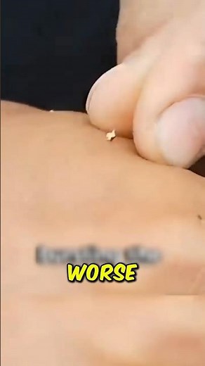 HOW TO REMOVE A BEE STINGER ⚠️