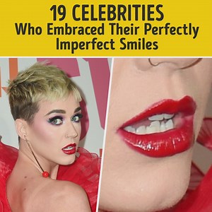 1.6M views · 5.3K reactions | 19 celebrities who embraced their perfectly imperfect smiles: | Bright Side | Facebook