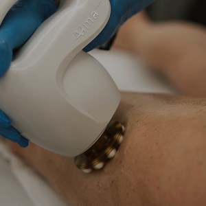  AccentPrime: Cellulite e Ritenzione idrica! ⠀ ⠀ La radiofrequenza...