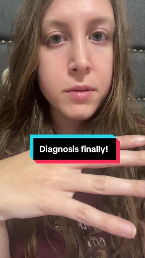 Understanding Scleroderma Diagnosis Journey