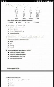 The diagram shows the four types of human tooth.[Diagram of i... | Filo
