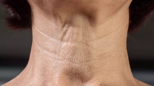 4 exercises to remove neck lines naturally and tighten sagging skin
