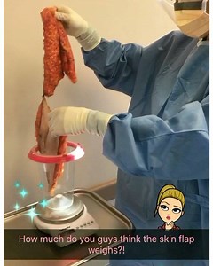 Measuring removed excess skin and fat during a tummy tuck procedure. It's pretty fascinating. Don't forget to watch today's surgery on @beautybydrcat IG stories and my Snapchat beautybydrcat #tummytuck #plasticsurgery @surgeon | Dr. Cat Begovic