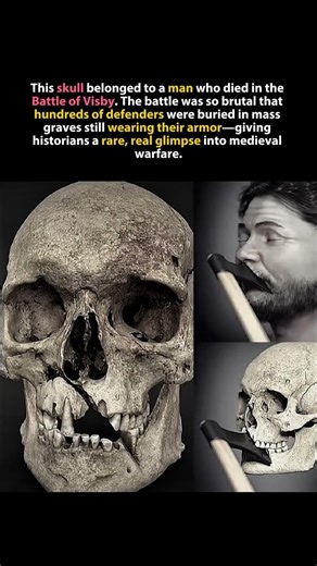 The Skull That Revealed the Brutality of Medieval Warfare