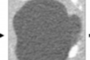 Alpha Data visualization, segmentation, augmentation