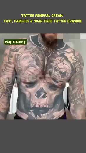 Transform Your Skin with Tattoo Removal Cream