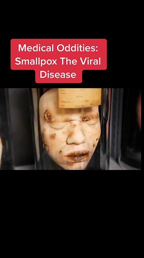 Diseases specimens at Mutter Museum#fy #fyp #BbStyleFearlessly #MACChallengeAccepted #medical #oddities #museum #mutter #love #virus #viral