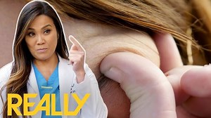 54K views · 357 reactions | 29 year old Lattyse struggles with migraines and immense head pain resonating from the dermoid cyst above her eyebrow she’s had since birth, as things get worse for her and with nowhere to turn Lattyse enlists the help of Dr Lee to remove this hinderance and help her retrieve her self esteem. Dr. Pimple Popper 1310 #pimple #popper #drpimplepopper #drsandralee | Pimple Daily Post | Facebook