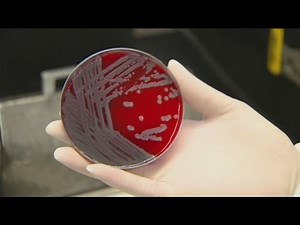 Officials waited months to announce outbreak