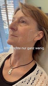 Viele wünschen sich Veranderung. Die meisten wünschen sich aber vor allem Natürlichkeit. Genau dort beginnt arztliche Entscheidung. #ÄsthetischeMedizin #MedizinMitHaltung #ÄrztlicheEntscheidung #NatürlicheÄsthetik #Behandlungsplanung WenigerIstMehr Gesichtsästhetik ErfahrungZählt PraxisImNorden ÄsthetikDeutschland SchönMitSinn | Praxis im Norden