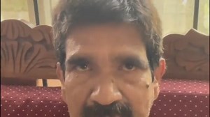 7.4K views · 78 reactions | Upbeat nystagmus It is a type of central...