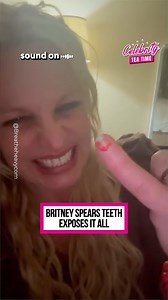 Something about Britney’s smile is raising eyebrows — and fans are buzzing with speculation. Are those subtle changes hiding behind cosmetic upgrades—or revealing deeper drama? Her glow is gone, and followers can’t help but wonder: what's really behind that transformation? | Celebrity Tea Time