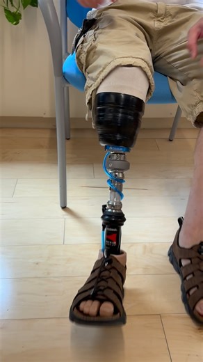 The new #ottobockquickchangeadapter is 🔥🔥. Jason has found that when driving the ability to remove his prosthetic foot makes it more comfortable for him. He was thrilled! @amputeecoalition #prostheticsinmotion #teampim #amputee #amputeesofinstagram #amputeestrong #mobility #prosthetics #limbloss #amputeesolutions #disabilityawareness #limbdifference #newyork #adaptandovercome #transtibial #vaccumprosthesis #belowthekneeamputee #belowtheknee #lowerlimbprosthesis #prostheticleg #transtibialamput