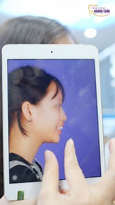 ✨ RĂNG HẾT HÔ CHÌA NHỜ NIỀNG RĂNG THẨM MỸ Cả nhà nhớ Follow kênh TIK TOK của Nha khoa Dr Hoàng Tuấn tại đây nhé: https://www.tiktok.com/@nhakhoa.hoangtuan ---------------------- 👉 Tham khảo chi tiết dịch vụ tại đây: - Bọc sứ thẩm mỹ: https://www.nhakhoahoangtuan.vn/rang-su-tham-my - Niềng răng thẩm mỹ: https://www.nhakhoahoangtuan.vn/nieng-rang-tham-my - Trồng răng Implant: https://www.nhakhoahoangtuan.vn/trong-rang-implant - Phẫu thuật cười hở lợi: https://www.nhakhoahoangtuan.vn/cuoi-ho-loi #