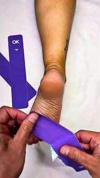 “STOP Heel Pain in 60 Seconds 👣 | Plantar Fasciitis Taping Demo”