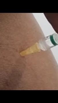 Girl getting injection painful #drrajneeshkant