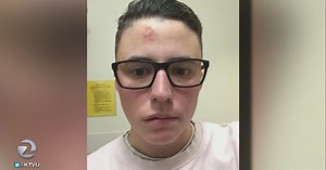 Transgender student assaulted on De Anza College campus