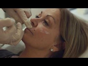 Cheek filler - Glasgow / London. Juvederm Voluma.