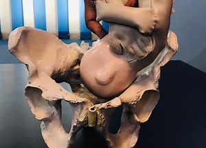 Mechanism of Normal Labour