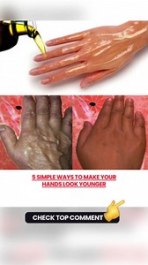 9K views · 60 reactions | 5 Simple Ways To Make Your Hands Look Younger Must express something to keep getting my recipes  Full recipe in the first comment  | We Love Health Tips | Facebook