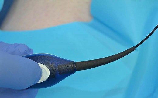 Radiofrequency Ablation - Varicose Vein Treatment