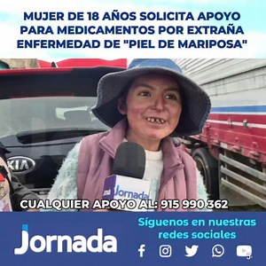 232K views · 5.3K reactions | Olga Astuyauri Ccahuay, una mujer de 18 años pide apoyo para sus medicamentos por una enfermedad genética rara y crónica llamada "piel de mariposa" que causa una extrema fragilidad en la piel donde el más mínimo roce provoca ampollas, heridas y desprendimiento de ésta. Cualquier apoyo llamar al 915 990 362 | Diario Jornada | Facebook