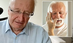 Monkeypox: Rare disease explained