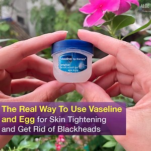 5.9K views · 609 reactions | The Real Way To Use Vaseline and Egg for Skin Tightening and Get Rid of Blackheads | Aloe Beautiful | Facebook