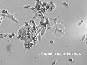 Have you seen REAL STEM CELLS? These embryonic mouse stem cells are turning into neurons. | UCSF