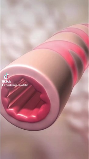 36K views · 209 reactions | A asma brônquica – ou mais popularmente...