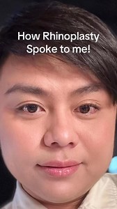 Another you, but better transformation‼️✨ Ruby RJ aka Riri 6 months post -op Rhinoplasty by Dr. Arvin of RPS Aesthetics. 👨🏻‍⚕️ 📣 JUNE PROMO ALERT: Book your consultation and schedule your rhinoplasty this June and get **₱10,000 OFF!**⁠ Let’s make it you but better here at RPS Aesthetics. 👇🏻 👩🏻‍⚕️ RPS Aesthetics ☎️ (02) 7001 3150 Viber: ( 63) 976 202 0689 Whatsapp: ( 63) 953 712 8199 📍 J & S Building, 104 Kalayaan Avenue, Diliman, Quezon City Other clinic locations: 📍 Cinco Marias Aesthe