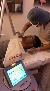 11K views · 49 reactions | Melasma & Scars Treatment Laser FACE 10...