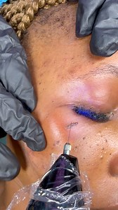 67 reactions · 10 comments | Laser tag’s removal Jumella Empire.. before and immediately after therapy… complete skin healing 7days final procedure will be posted #viralreelsシ2024 #reelsviralシ #viralreelsシ #viralreelsシ #viralpost2024 #viralpost2024 #facebookreelsviral #viralvideoシ #vuralreelsvideo #viralvideoシ #Viralシ #SkintagsRemover #darkknucklestreatment #skintagsolution #skintagtreatment | Stella Jumbo | Facebook