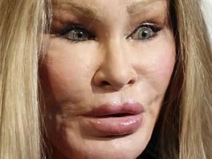 Plastic Surgery Disaster(Jocelyn Wildenstein)