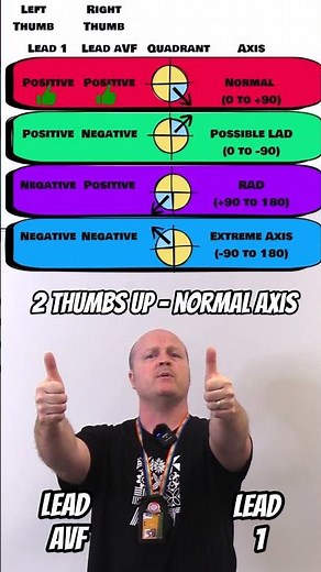 Cardiac Axis - How to use your thumbs to calculate cardiac axis