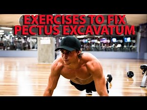 Exercises to fix Pectus Excavatum
