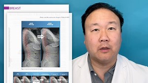 PRS Social Media Editor, Dr. Roy Kim, discusses the article, “Breast Hypertrophy: A Real Pain in the Back” by Lessard, Papanastasiou, Fortin, and Ouellet. Read it today: https://bit.ly/BreastHypertrophyPain | Plastic and Reconstructive Surgery