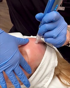 Do you want to improve the overall appearance of your skin and reduce...