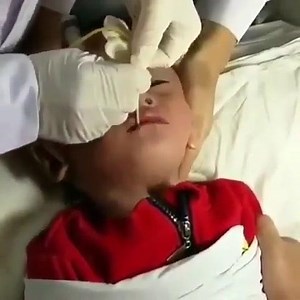 3.4K views · 41 reactions | Trying to remove a swallowed coin by this kidHow would you handle this case? | الصحة health | Facebook
