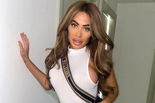 What did Chloe Ferry look like before surgery?