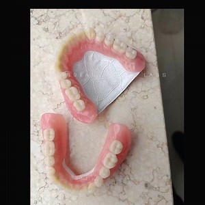 [Hot Item] Removable Full Completed Dentures Replacing The Missing Teeth Customize Dental Lab